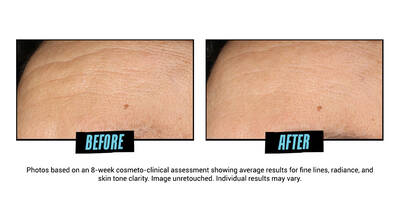 Before and After Glycolic Acid Serum