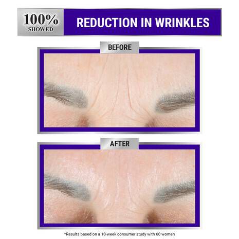 Retinol for wrinkles sale