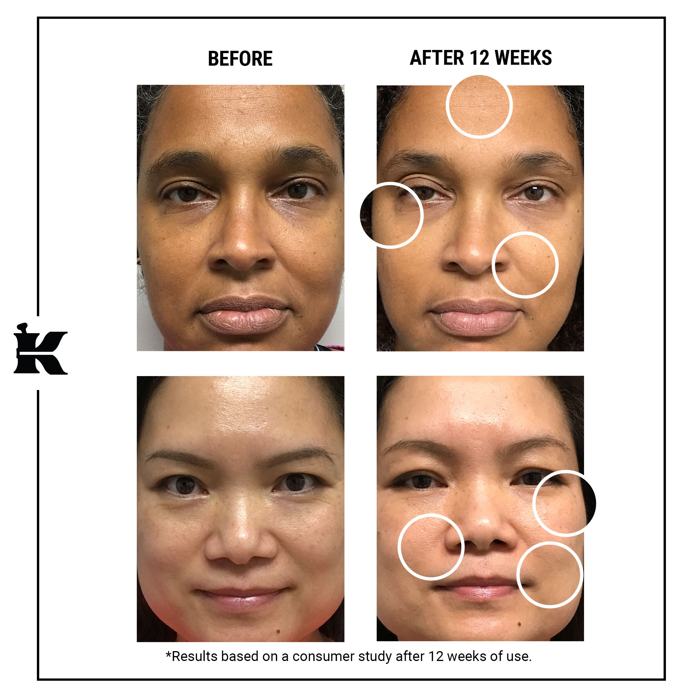 Retinol serum sales for face