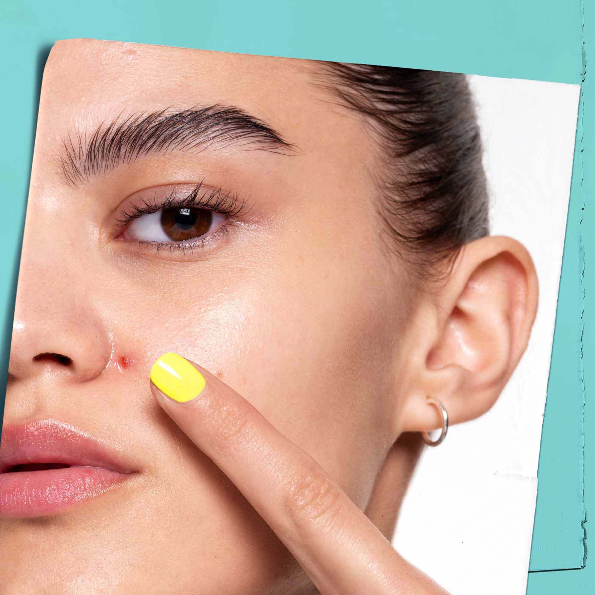 Truly Targeted Blemish Solution