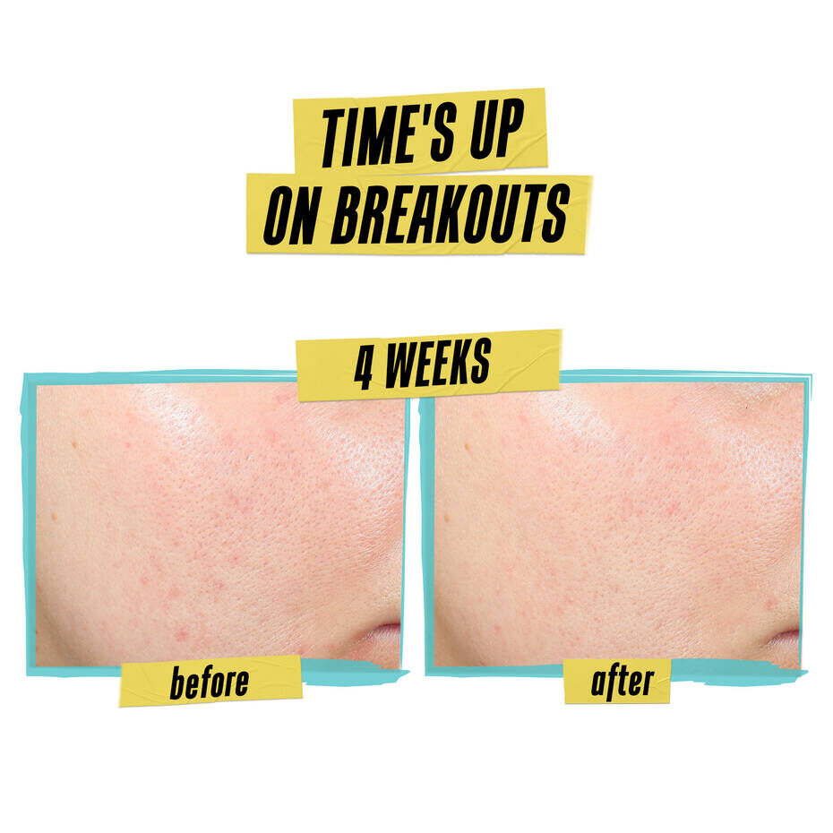 Expertly Clear Blemish-Targeting & Preventing Lotion