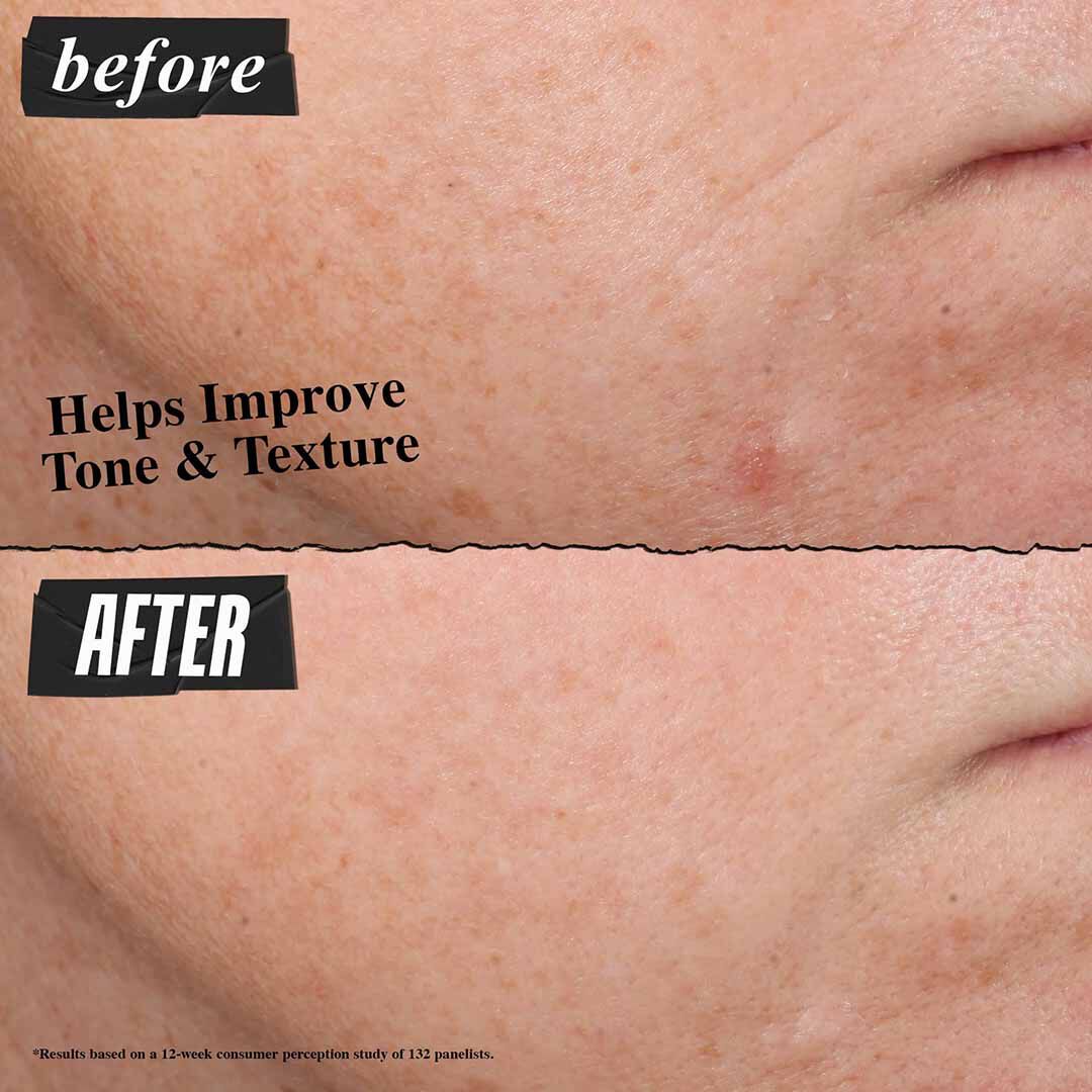 Retinol Skin-Renewing Daily Micro-Dose Serum