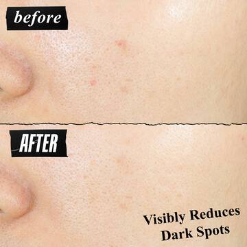 Clearly Corrective™ Dark Spot Solution