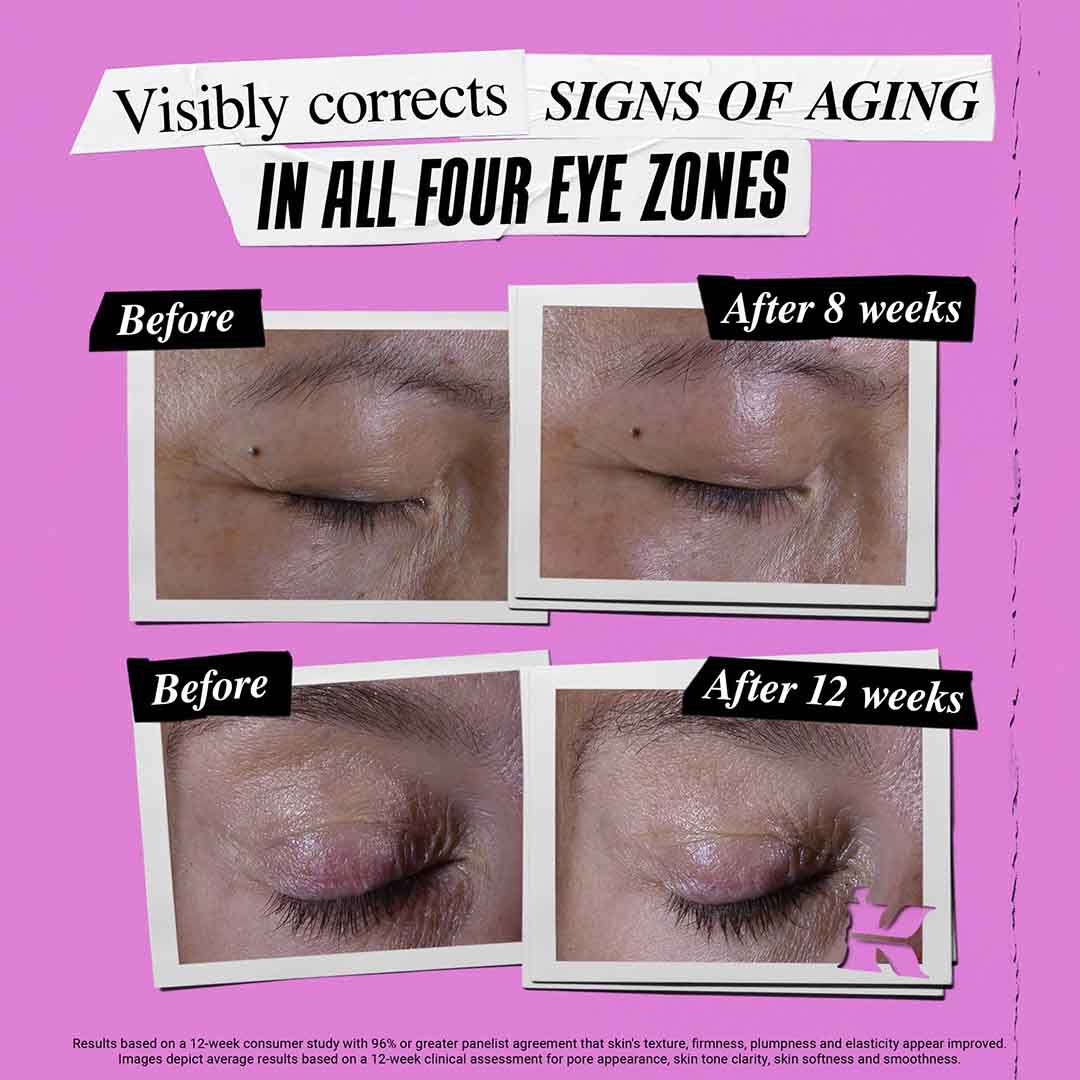 Super Multi-Corrective Eye Zone Treatment