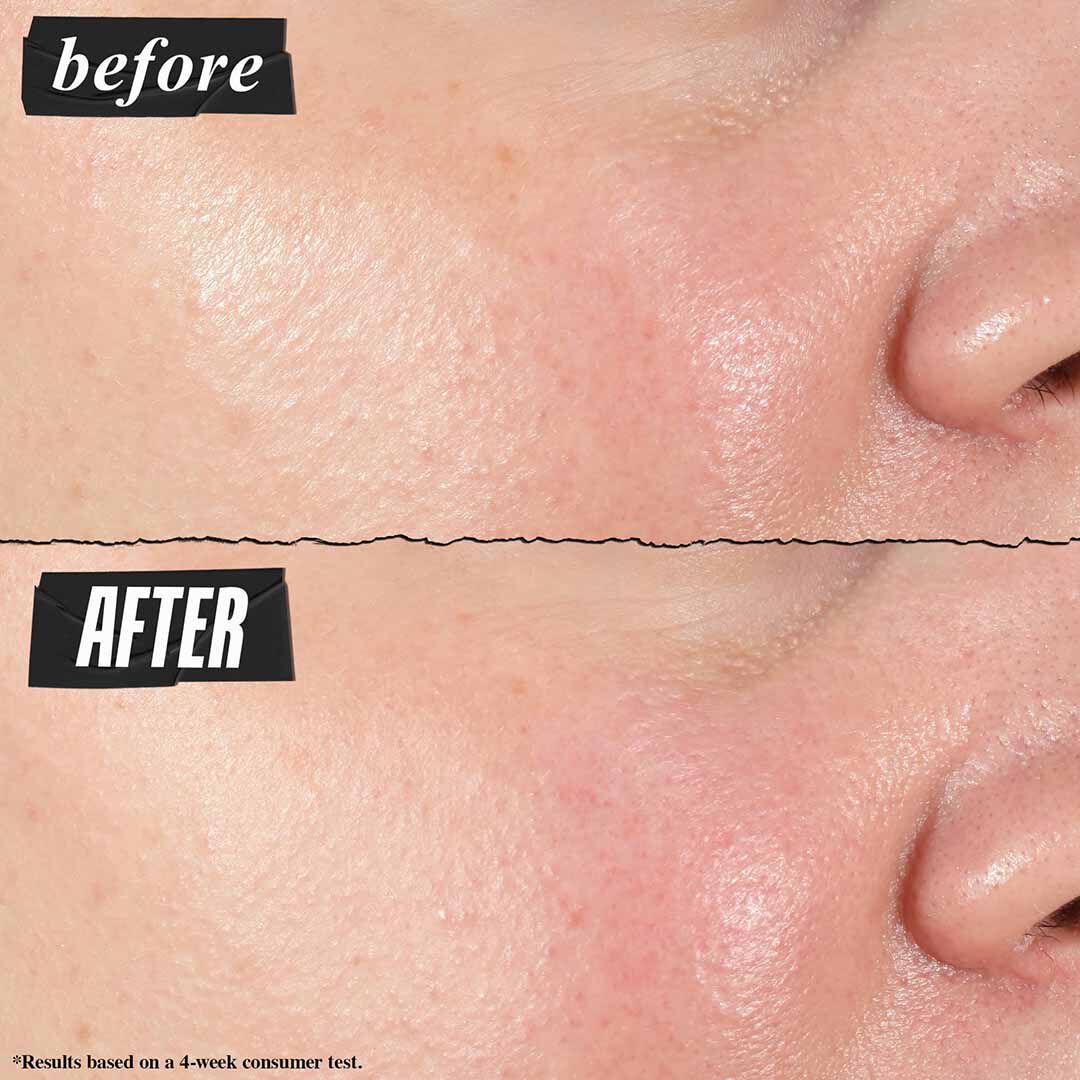 Hydro-Plumping Serum Concentrate