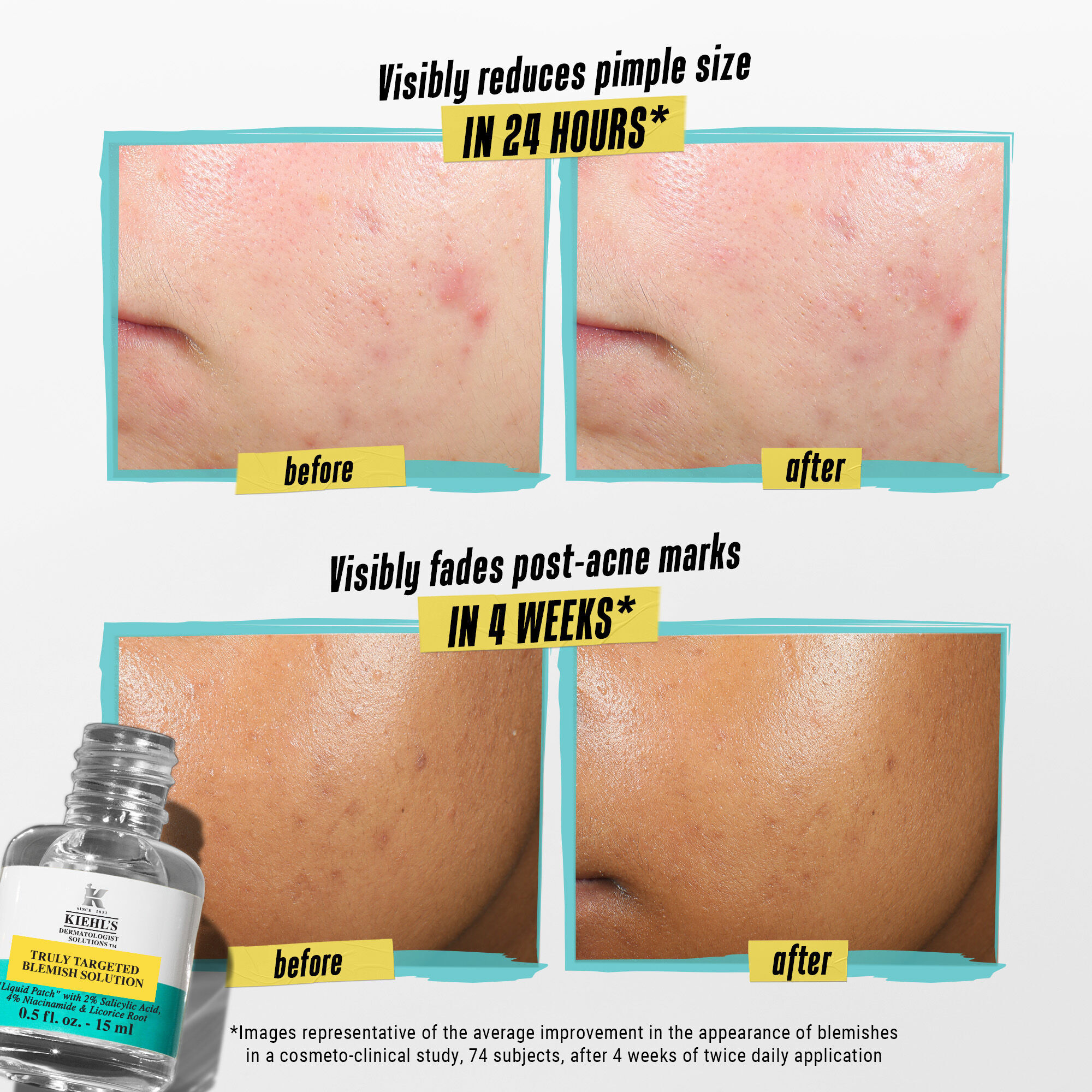 Truly Targeted Blemish Solution