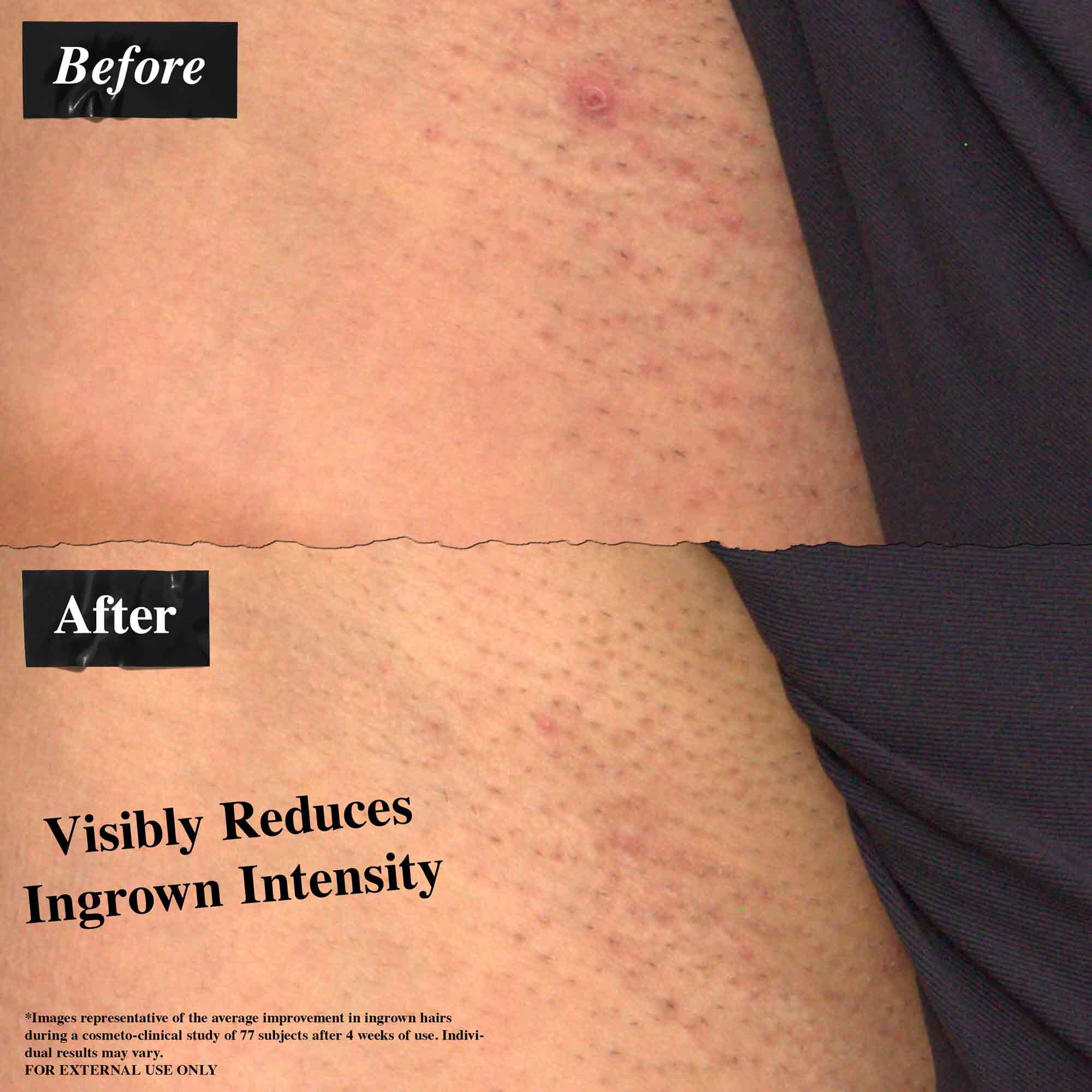 Ingrown Hair & Tone-Correcting Intimate Drops - Kiehl's Australia